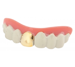 Dekoratīvie zobi ar zeltu