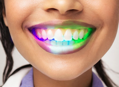 Dekoratīva LED zobu plāksne