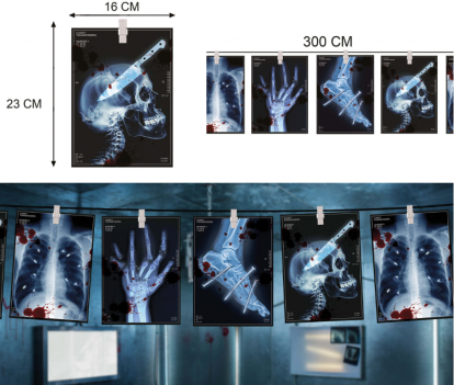Virtene "Rentgens" (3m)