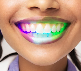 Декоративная светодиодная зубная пластина